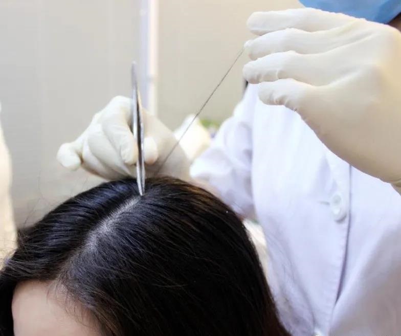 90%的养发师在检测脱发时都犯的错